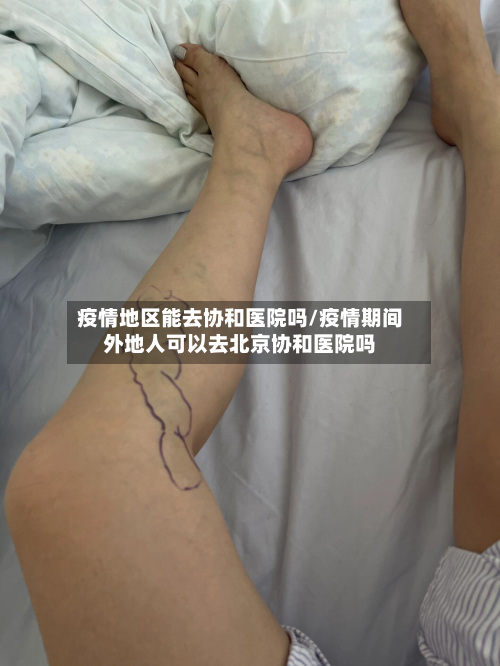 疫情地区能去协和医院吗/疫情期间外地人可以去北京协和医院吗-第3张图片